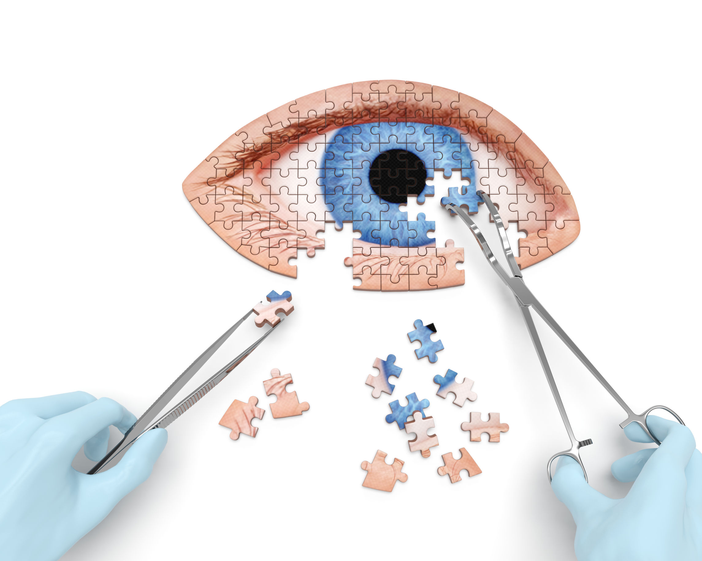 Eye operation