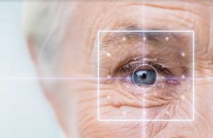 Dossier complet sur la cataracte des yeux