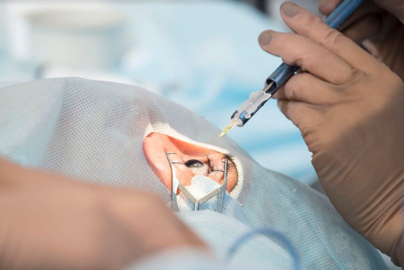 Lire la suite à propos de l’article Le traitement de la presbytie par la pose d’implant multifocal