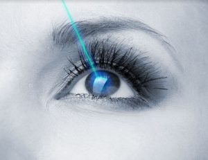 Les critères d’éligibilité aux opérations des yeux au laser