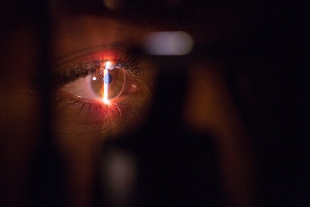 découvrez tout ce qu'il faut savoir sur la lasek (laser epithelial keratomileusis) : procédure, avantages, récupération, risques et résultats.