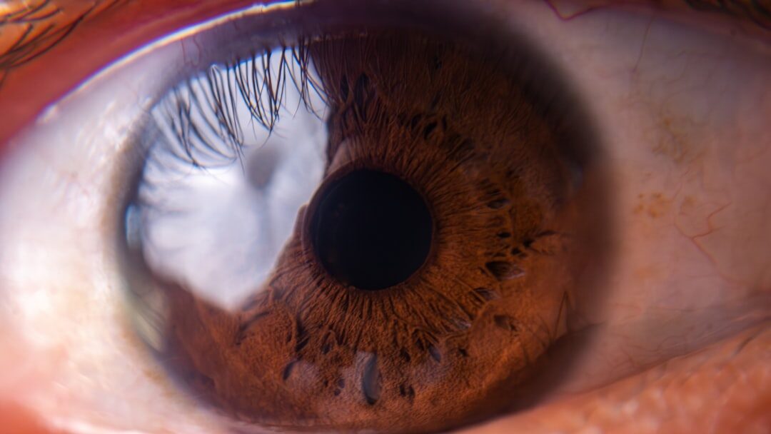 découvrez tout ce qu'il faut savoir sur la préparation à la chirurgie des yeux : conseils, étapes et informations indispensables pour aborder sereinement cette intervention.